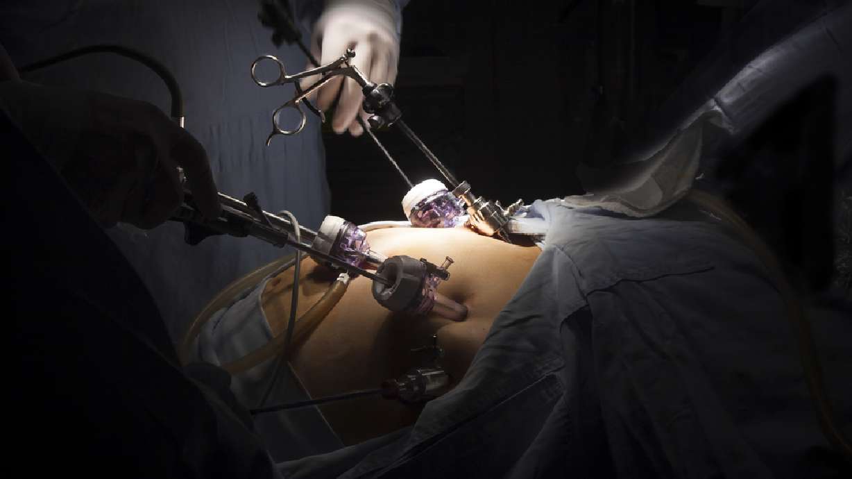 When dieting isn't enough: 4 options for medical weight loss