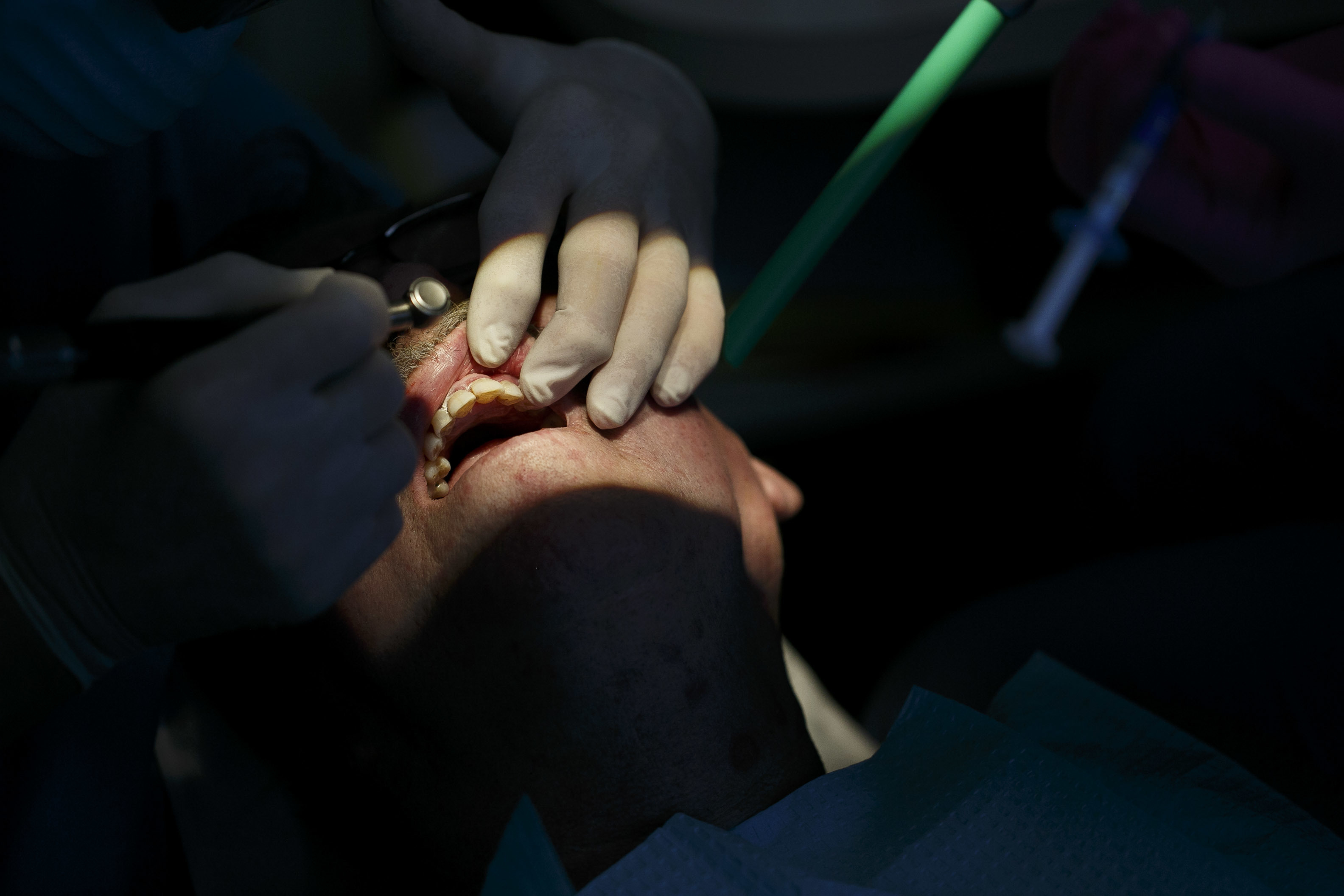 No dental insurance? Discount plans can provide savings