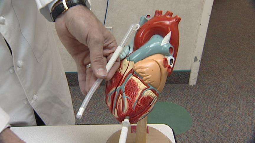 New Device Helping Babies with Heart Problems
