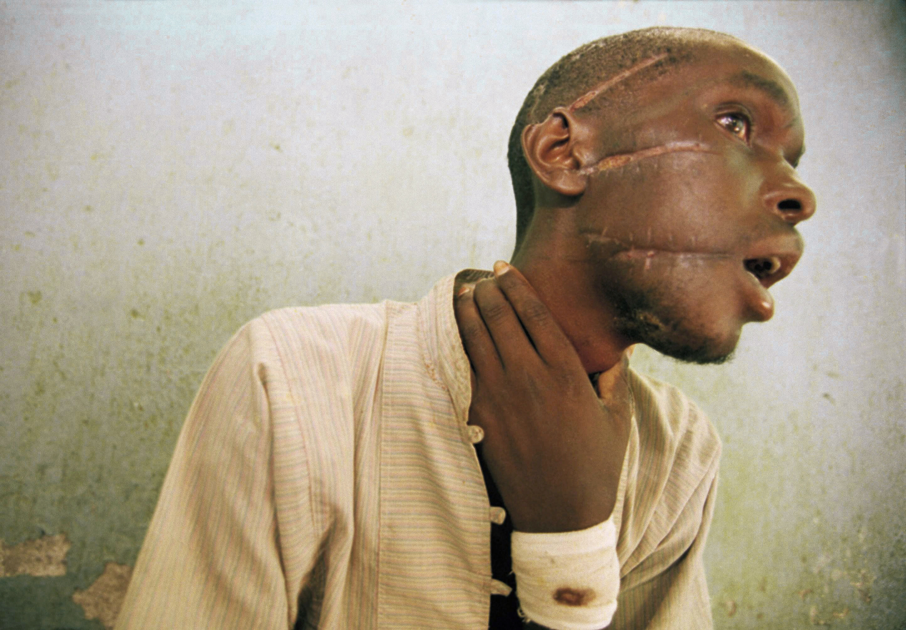 AP Photos: 25 years ago, images exposed Rwanda's genocide