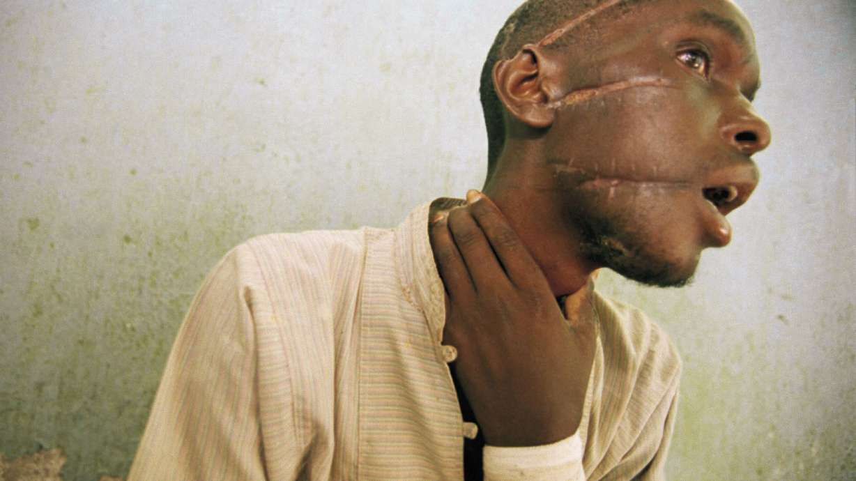 AP Photos: 25 years ago, images exposed Rwanda's genocide