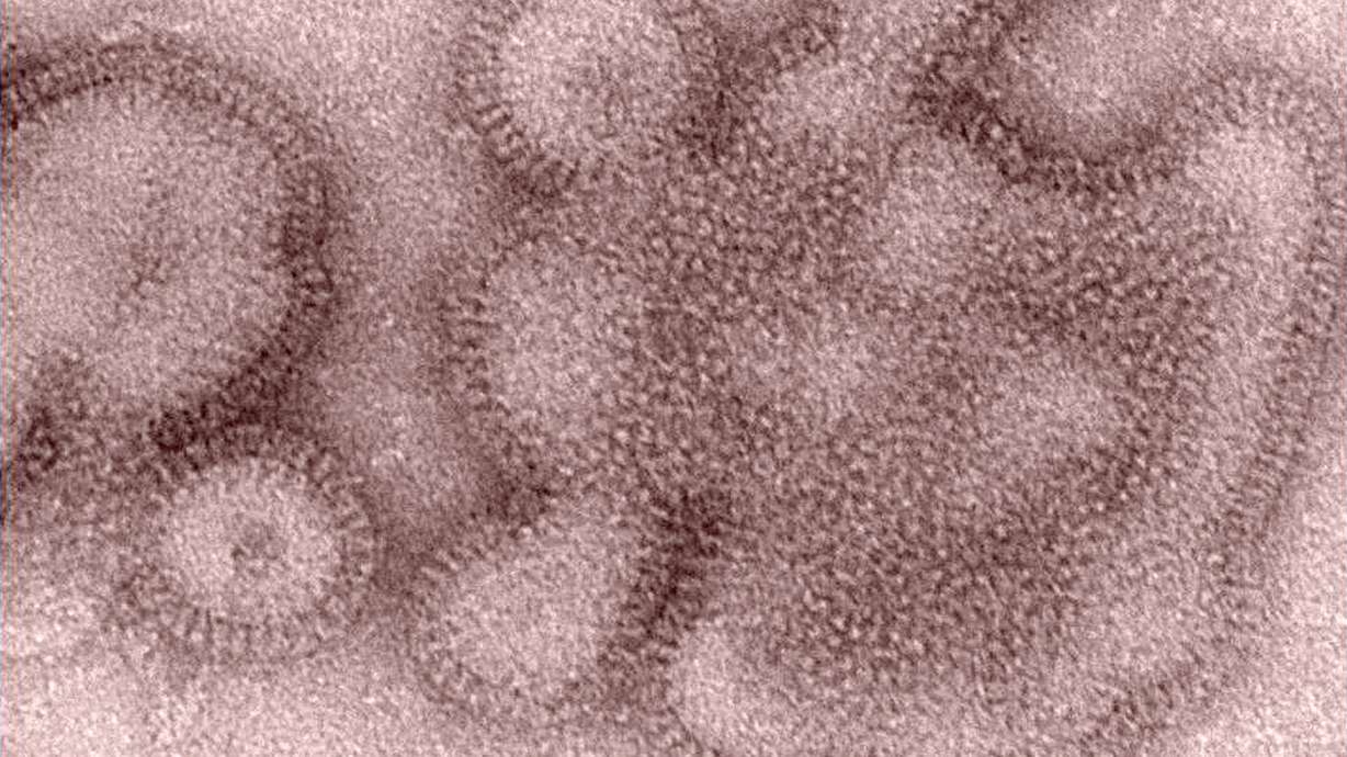 Two-wave US flu season is now the longest in a decade