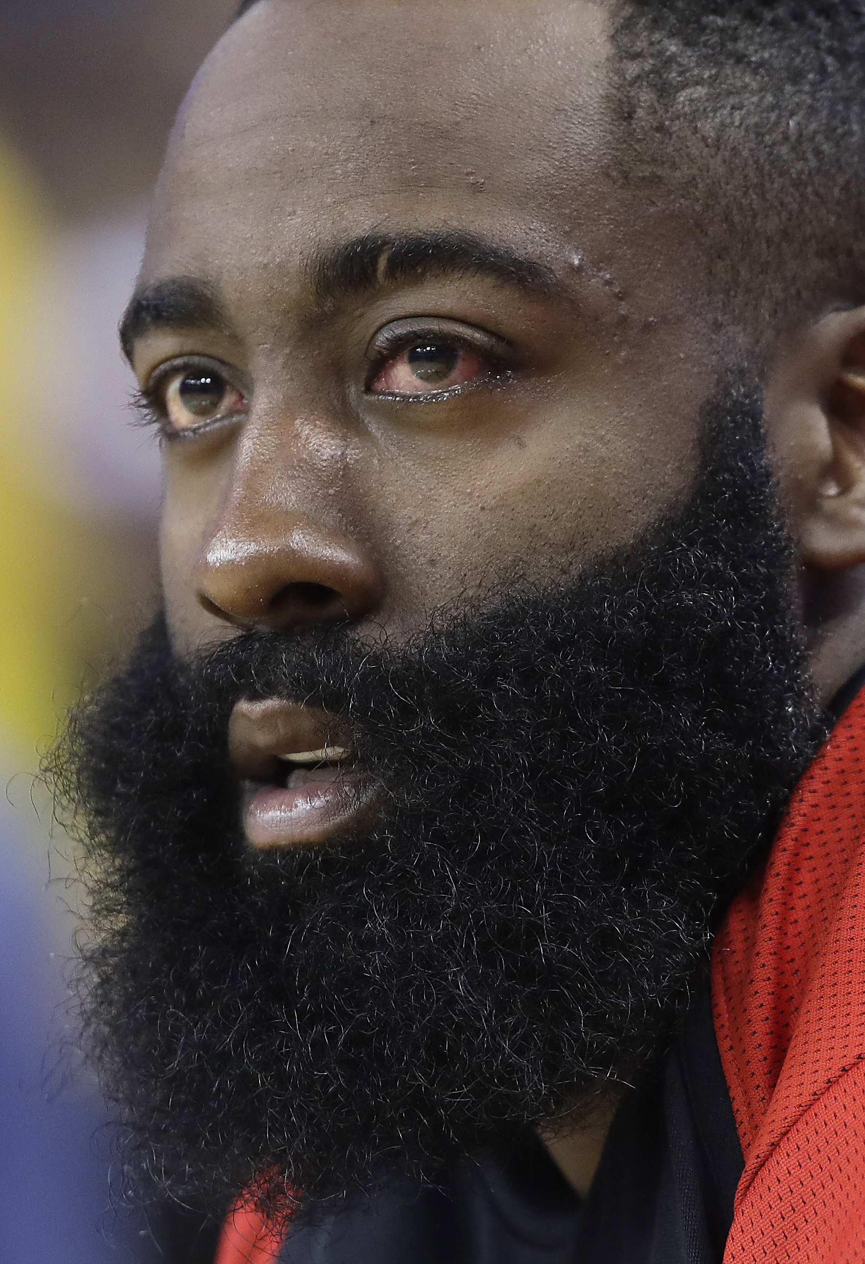 Harden still dealing with eye injury; will play in Game 3