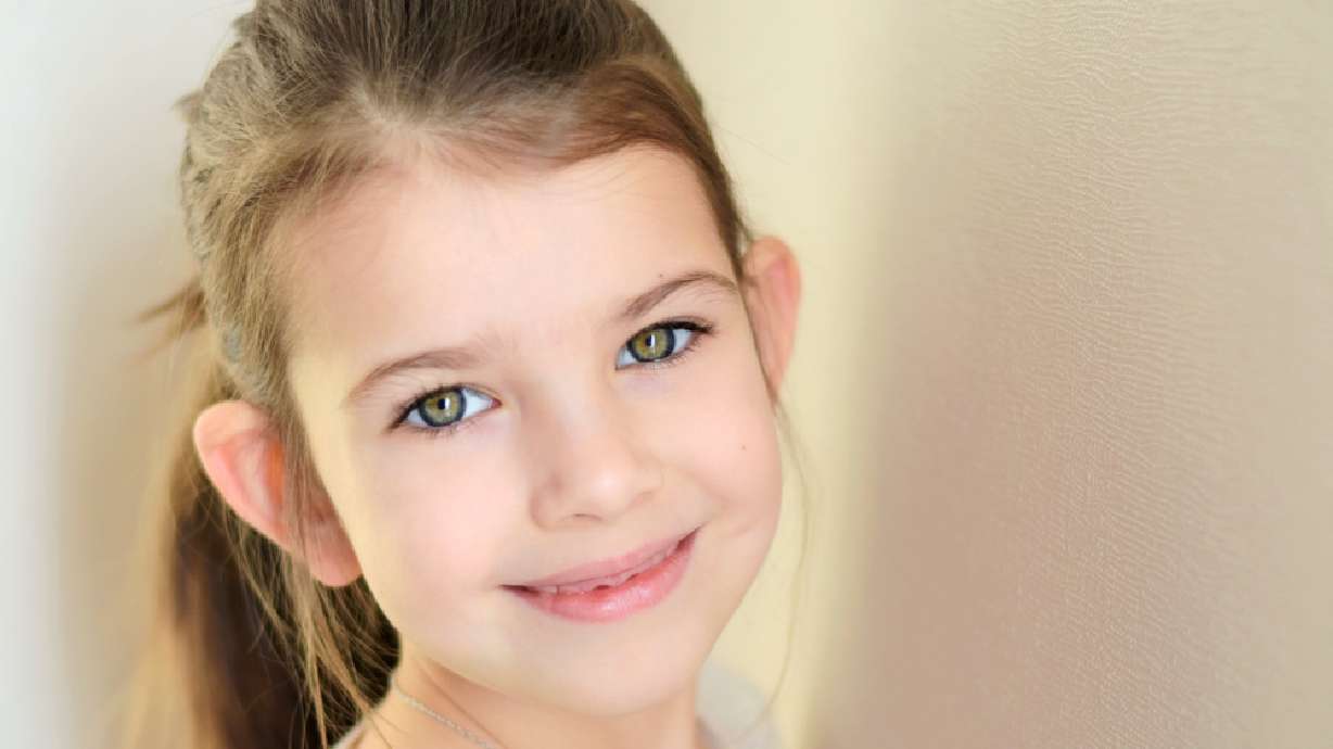 Overcoming the stigma of protruding ears