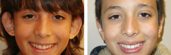 Photo courtesy of Utah Facial Plastic