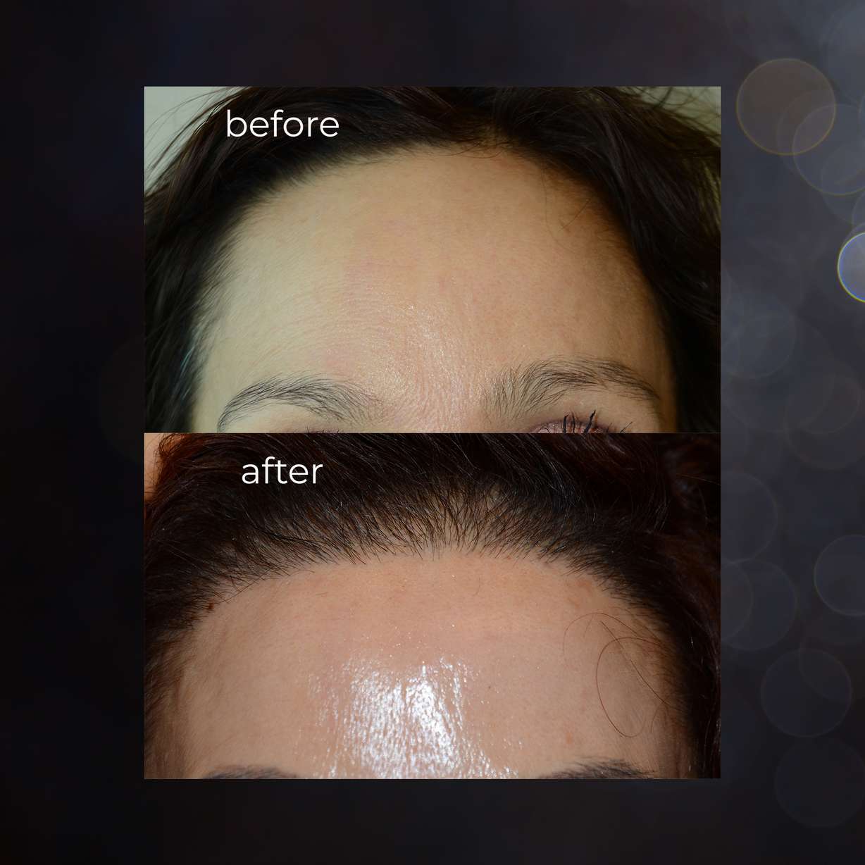 Photo courtesy of Utah Facial Plastics