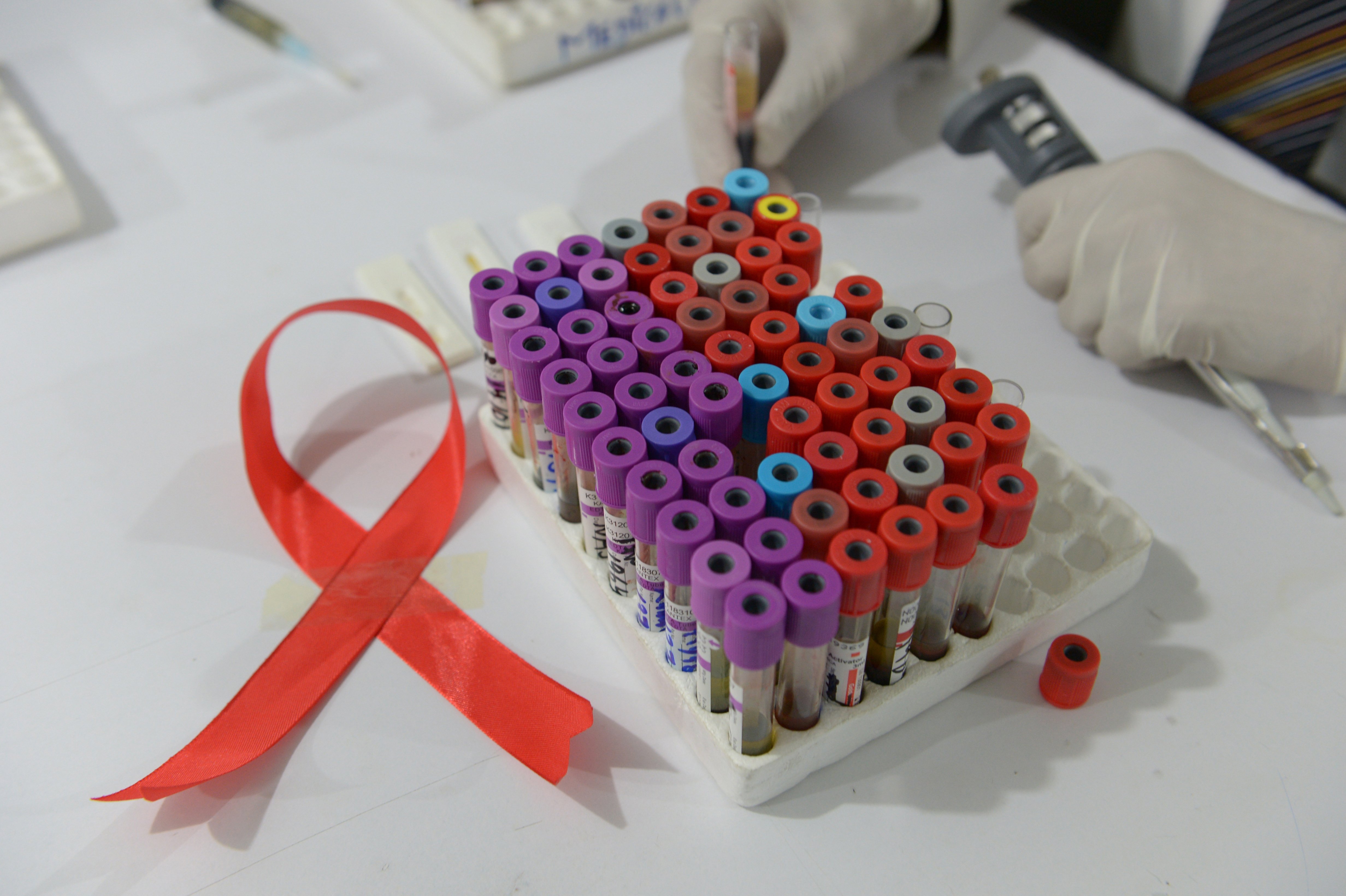 Researchers eliminated HIV from DNA of infected mice in first step towards cure