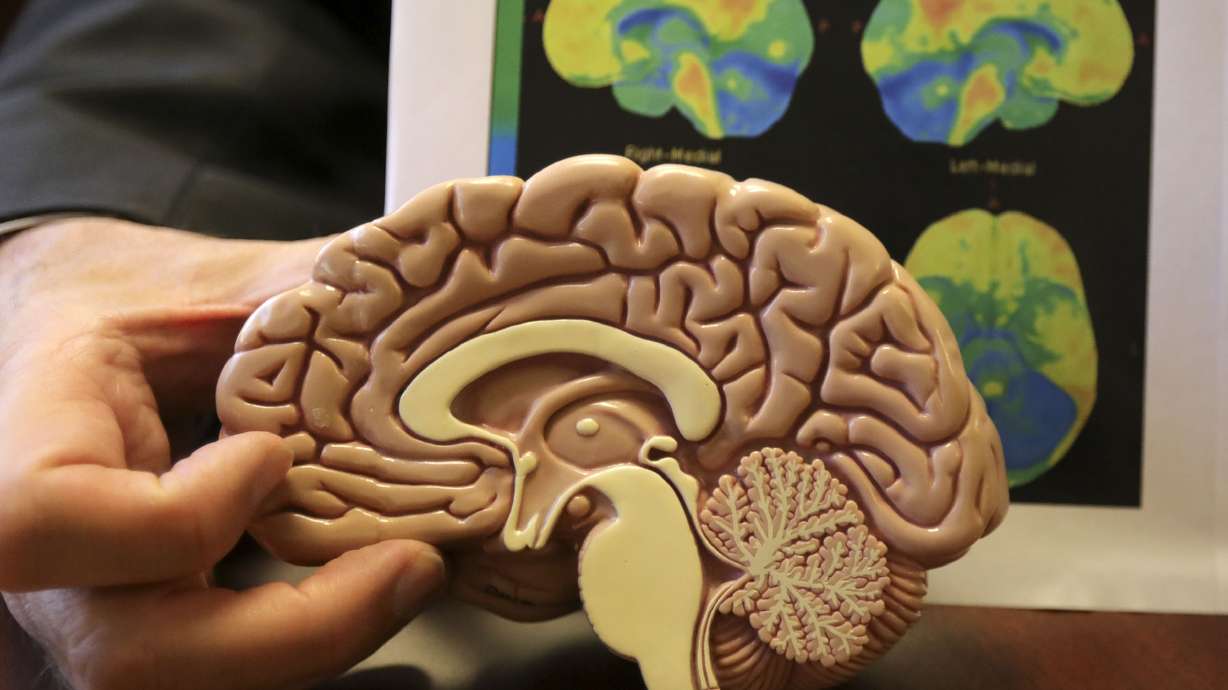 Utah specialist shortages make Alzheimer's numbers a growing problem