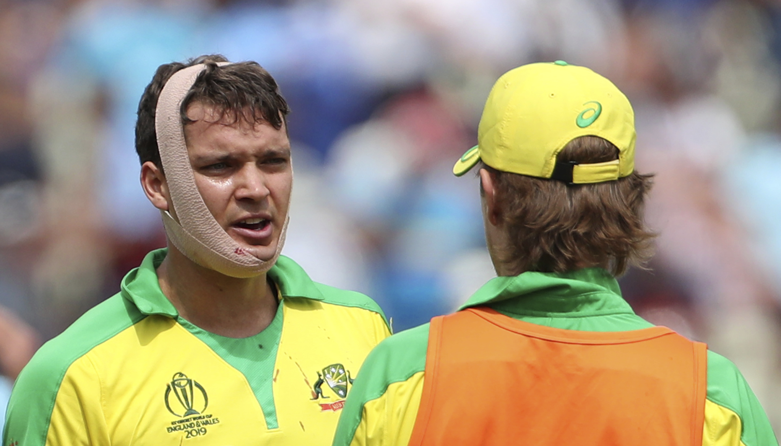 Helmet knocked off, bloodied Carey bats on for Australia