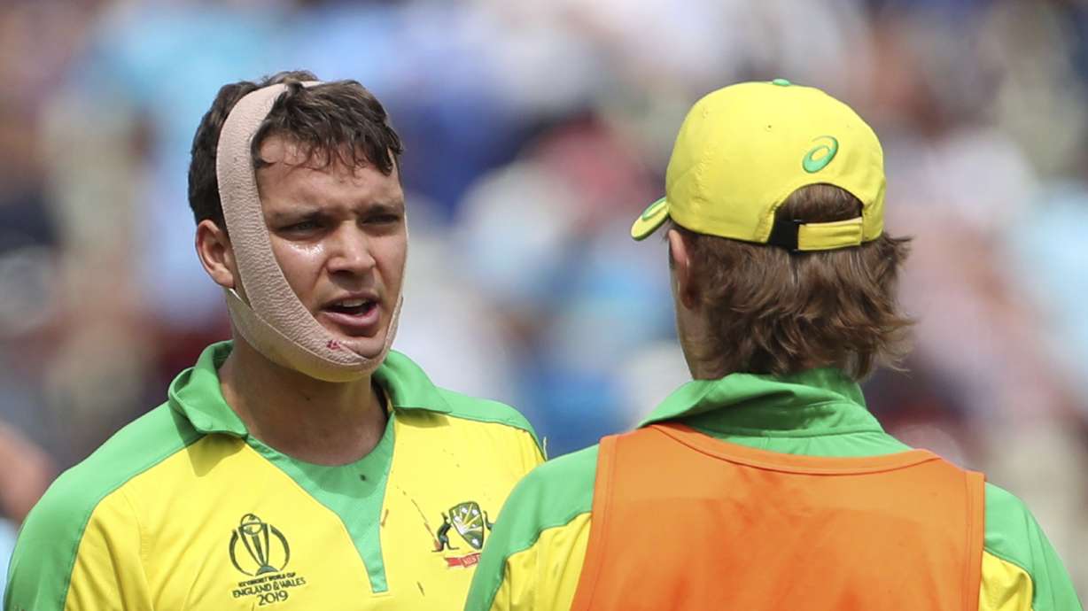 Helmet knocked off, bloodied Carey bats on for Australia