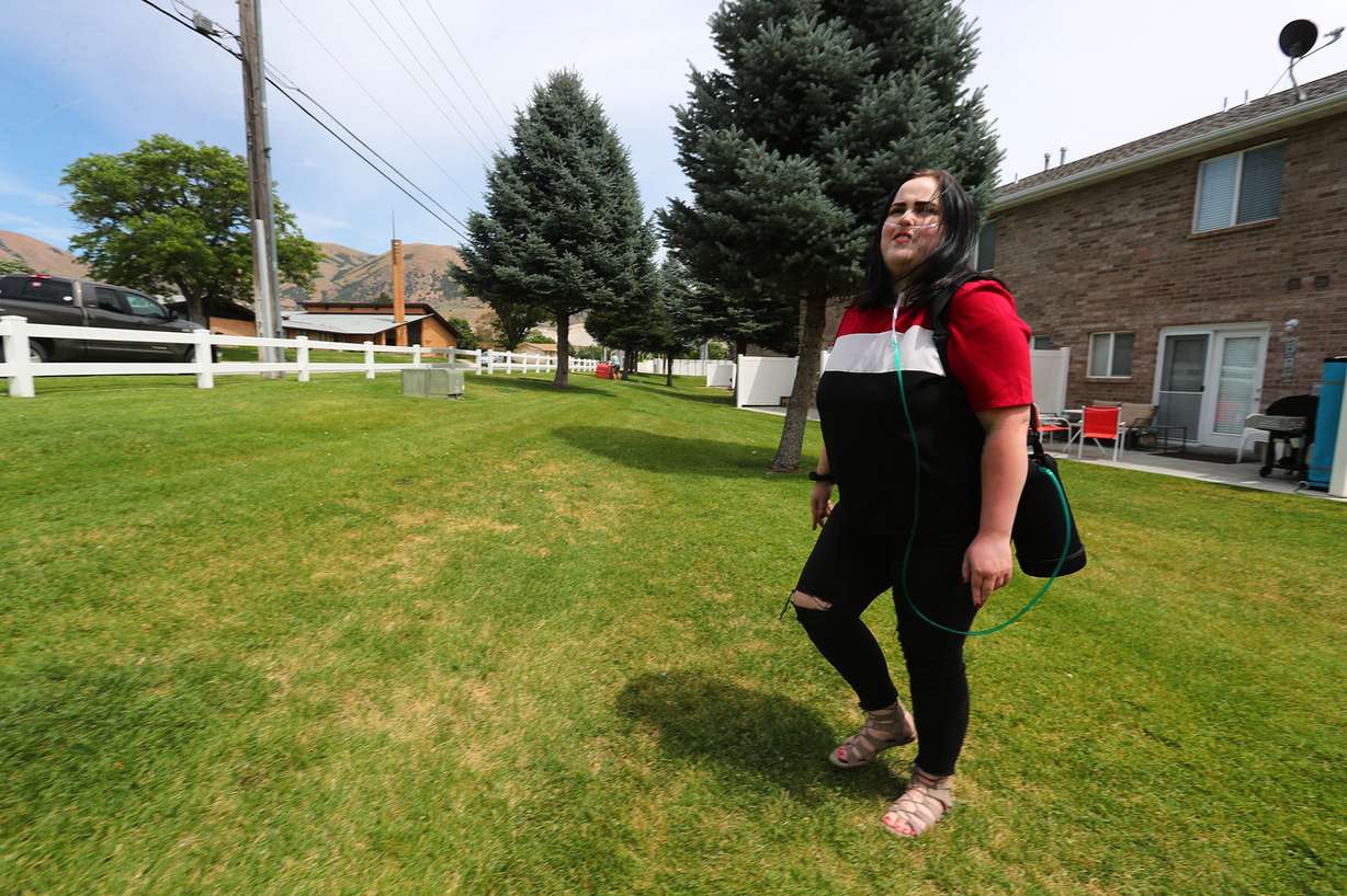 Aubree Butterfield, who was recently treated at the University of Utah Hospital for lipoid pneumonia linked to vaping, is pictured at her parents' home in Brigham City on Tuesday, Aug. 6, 2019. Earlier in the day, Butterfield joined doctors in discussing the dangers of vaping during a press conference at the Salt Lake hospital. (Photo: Scott G Winterton, KSL)