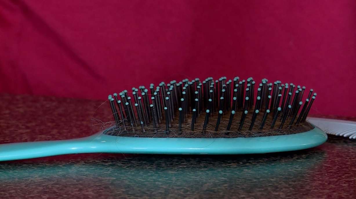 Dr. Jennifer Mijer said lice only spread through head to head contact or through brushes and hats. (Photo: KSL TV)