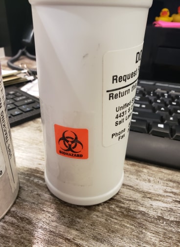 Denver woman mistakenly receives samples from Utah STD test in mail