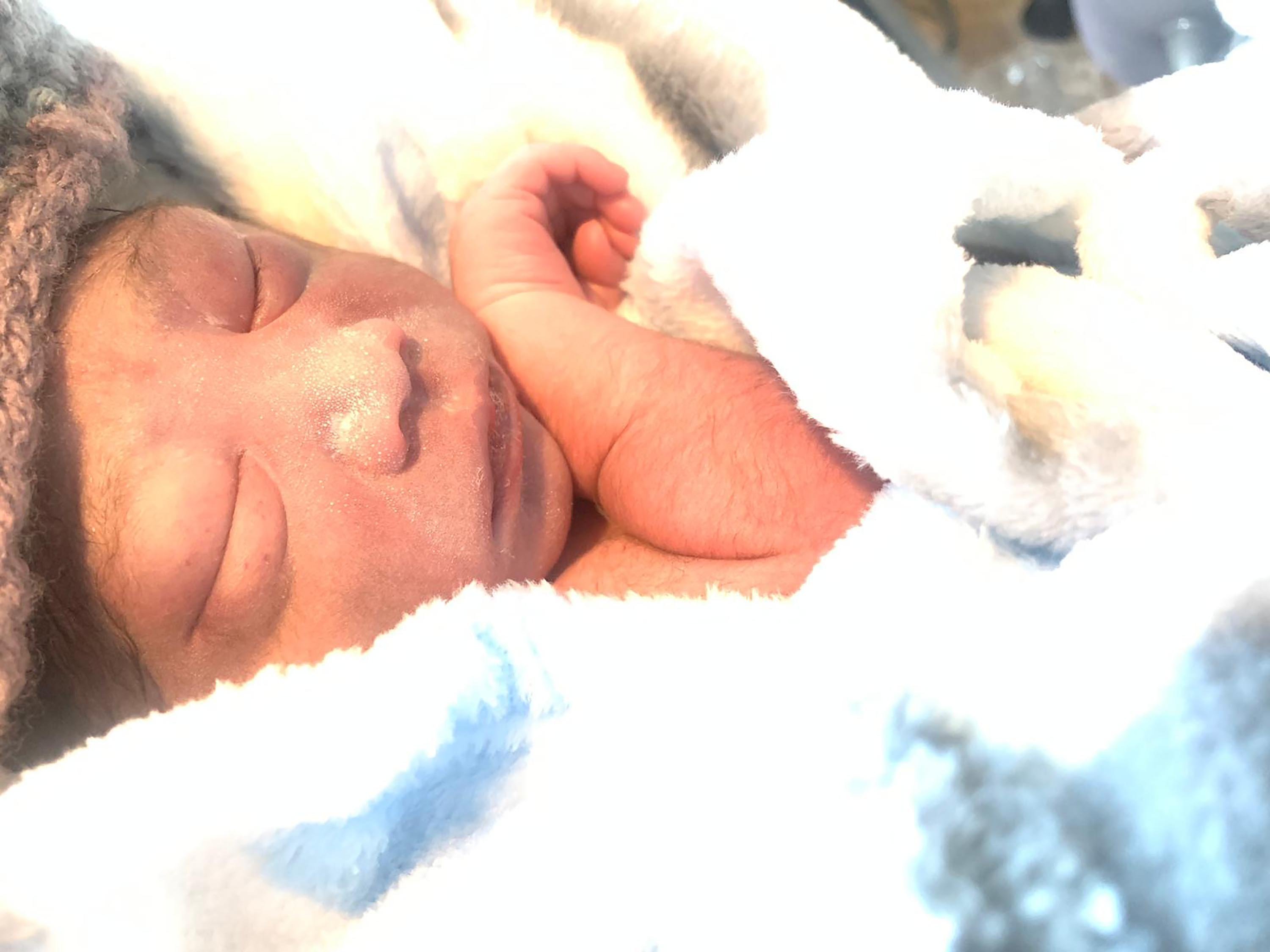 New Jersey baby first to survive birth without part of his skull