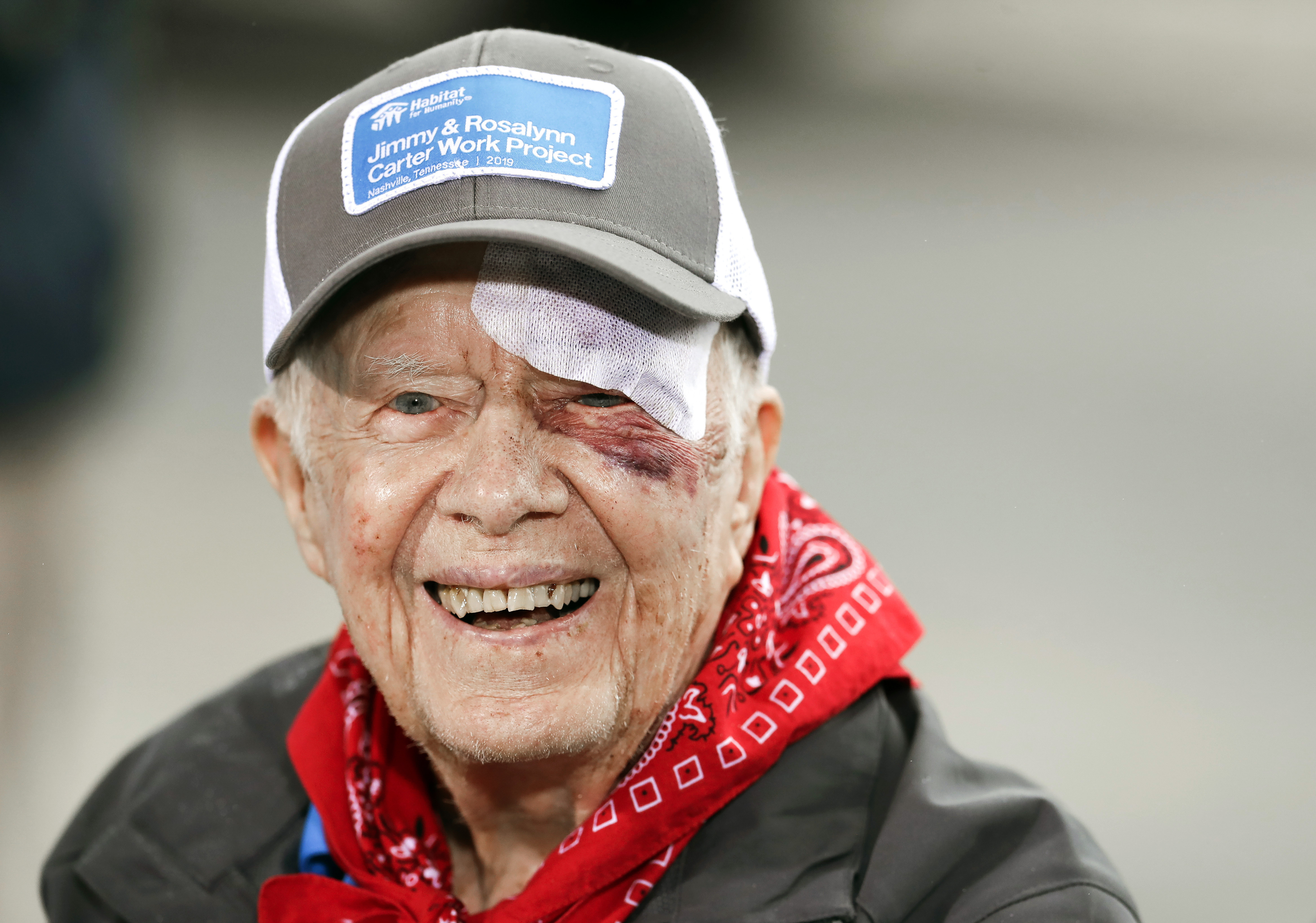 Jimmy Carter hospitalized after fall at Georgia home