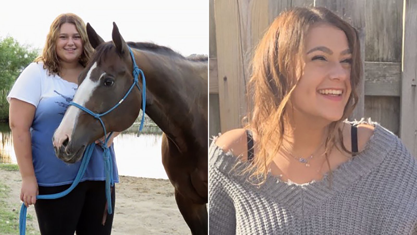 Pediatricians endorse weight loss surgery for severely obese kids and teens: 'It changed my life'