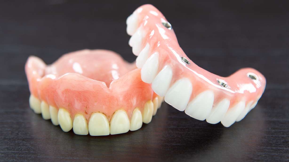 3 reasons you shouldn't settle for dentures