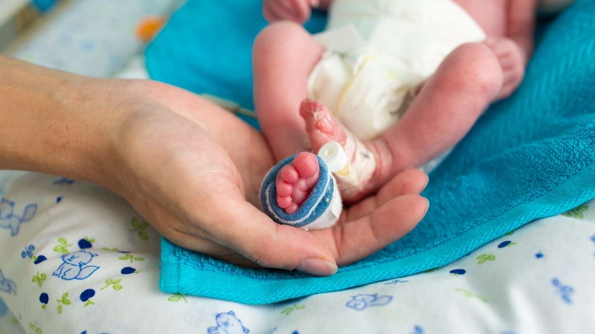 Premature births cost society billions, University of Utah economists say