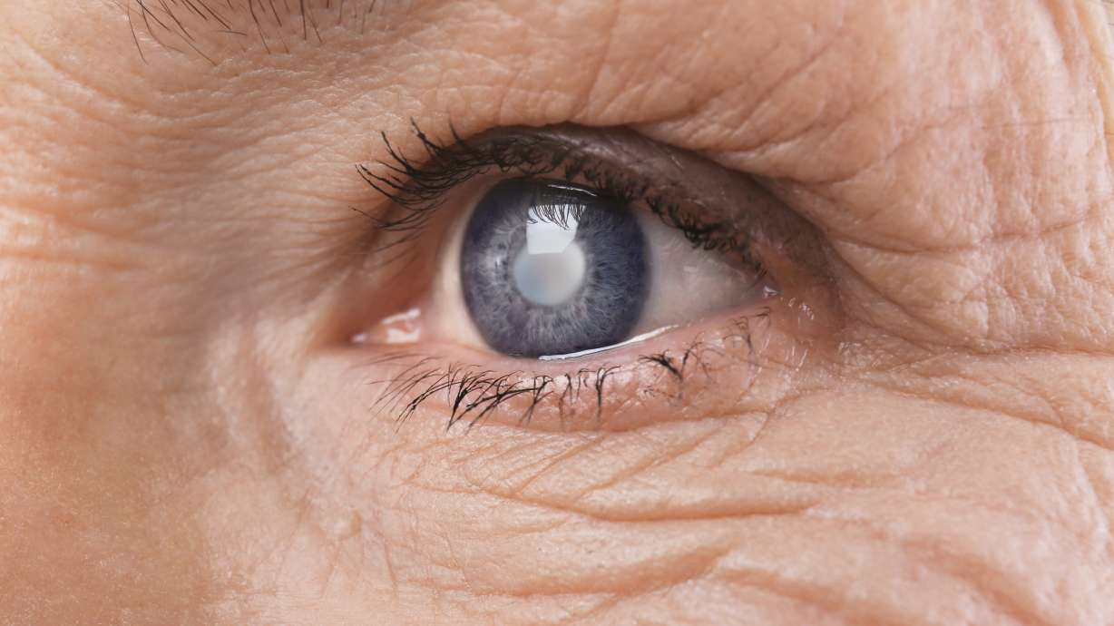 2 new breakthrough cataract lens technologies are here