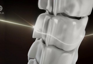 Graftless Bone Transplants Soon to Be Reality: ADAM Takes 3D Bones to Clinical Trials