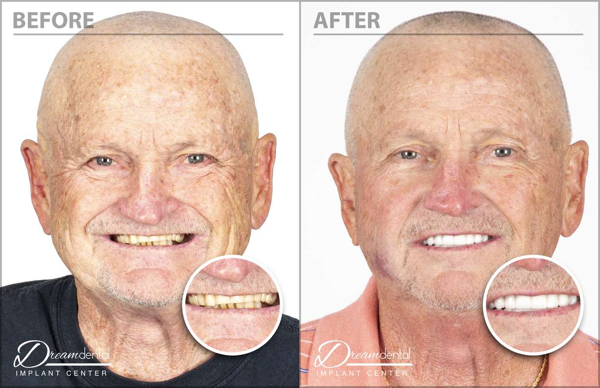 Courtesy of Dream Dental