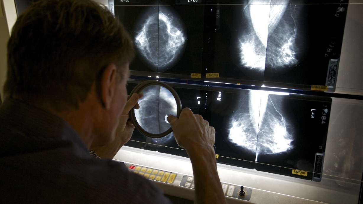 Breast cancer risk from menopause hormones may last decades