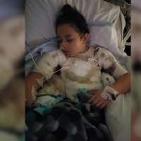 8-year-old girl severely burned after candle catches shirt on fire
