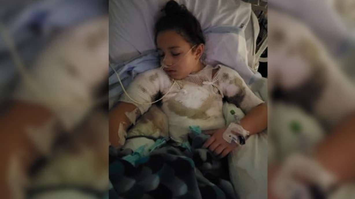8-year-old girl severely burned after candle catches shirt on fire