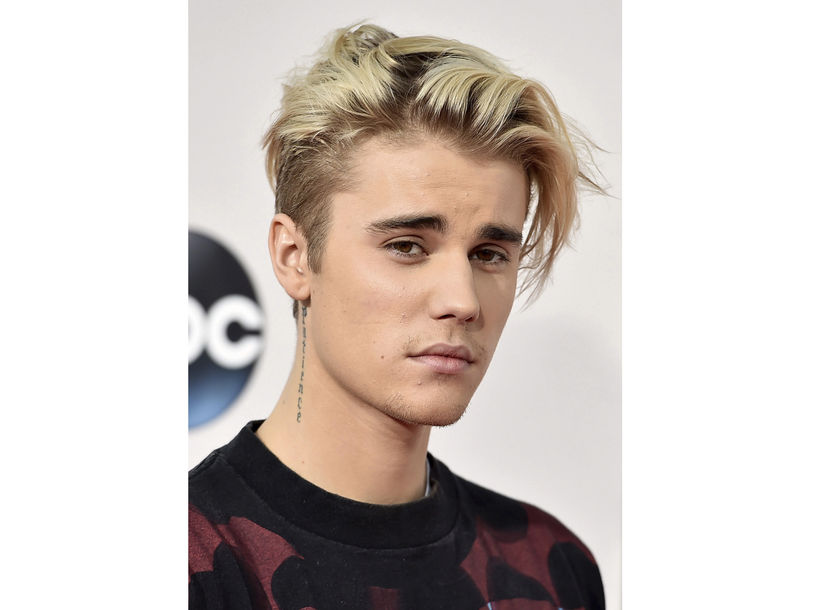 Justin Bieber says he's battling Lyme disease