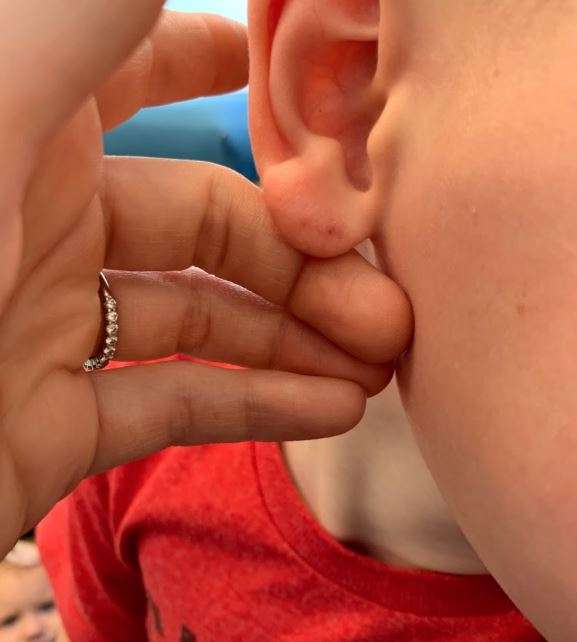 Katy and David’s son was possibly bitten by a bat during a family vacation. (Family photo)