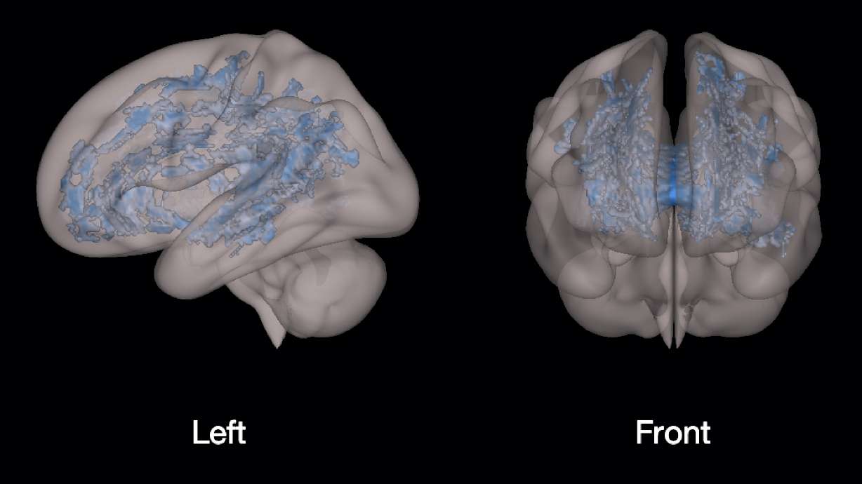 This is your child's brain on books: Scans show benefit of reading vs. screen time