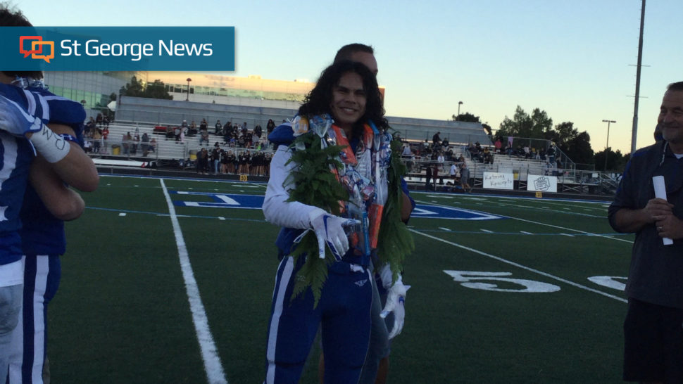 Parents praise coworkers for quick response to help son who severed hand in work accident