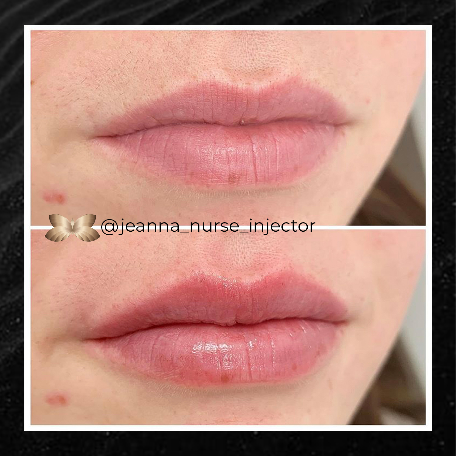 Courtesy of Utah Facial Plastics