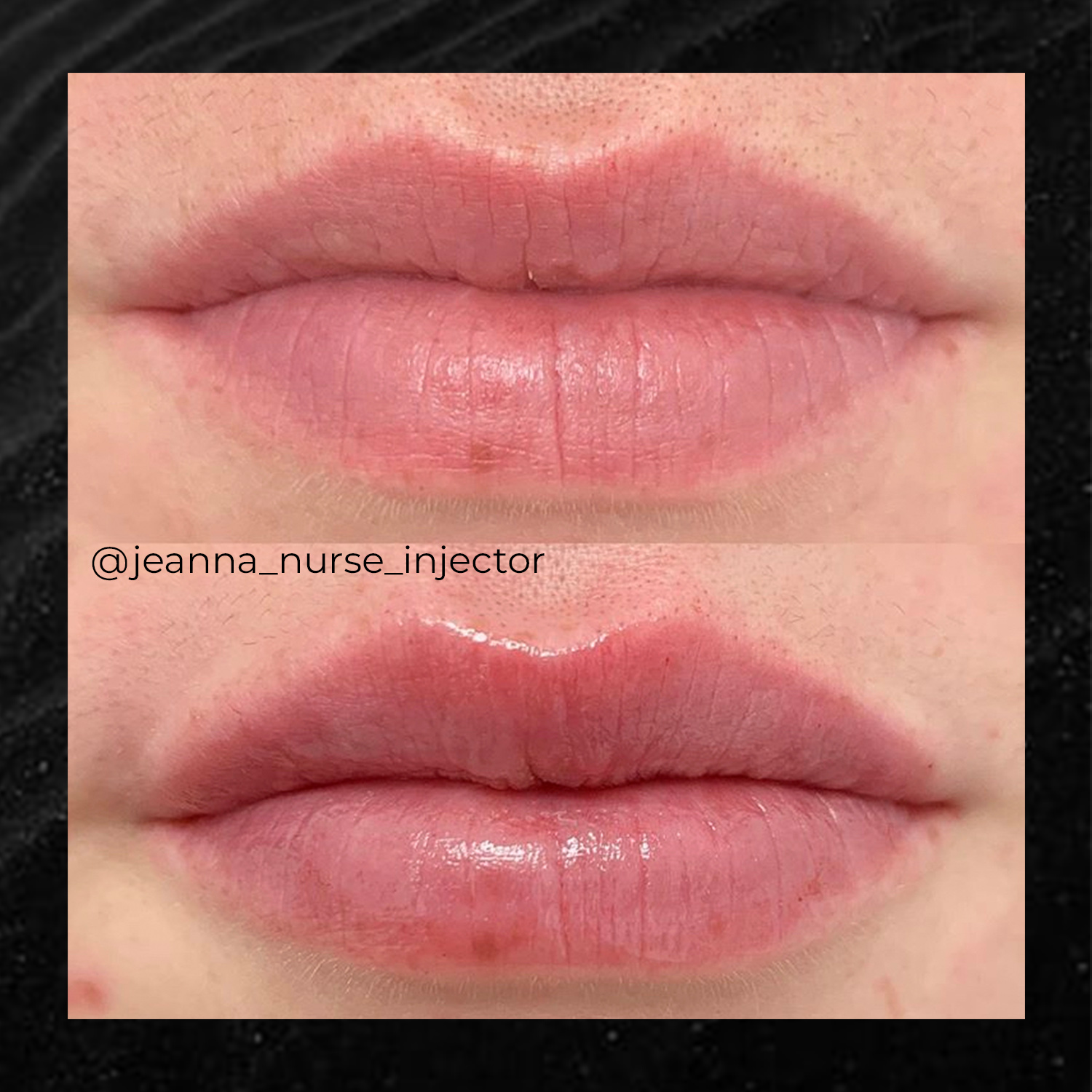 Courtesy of Utah Facial Plastics