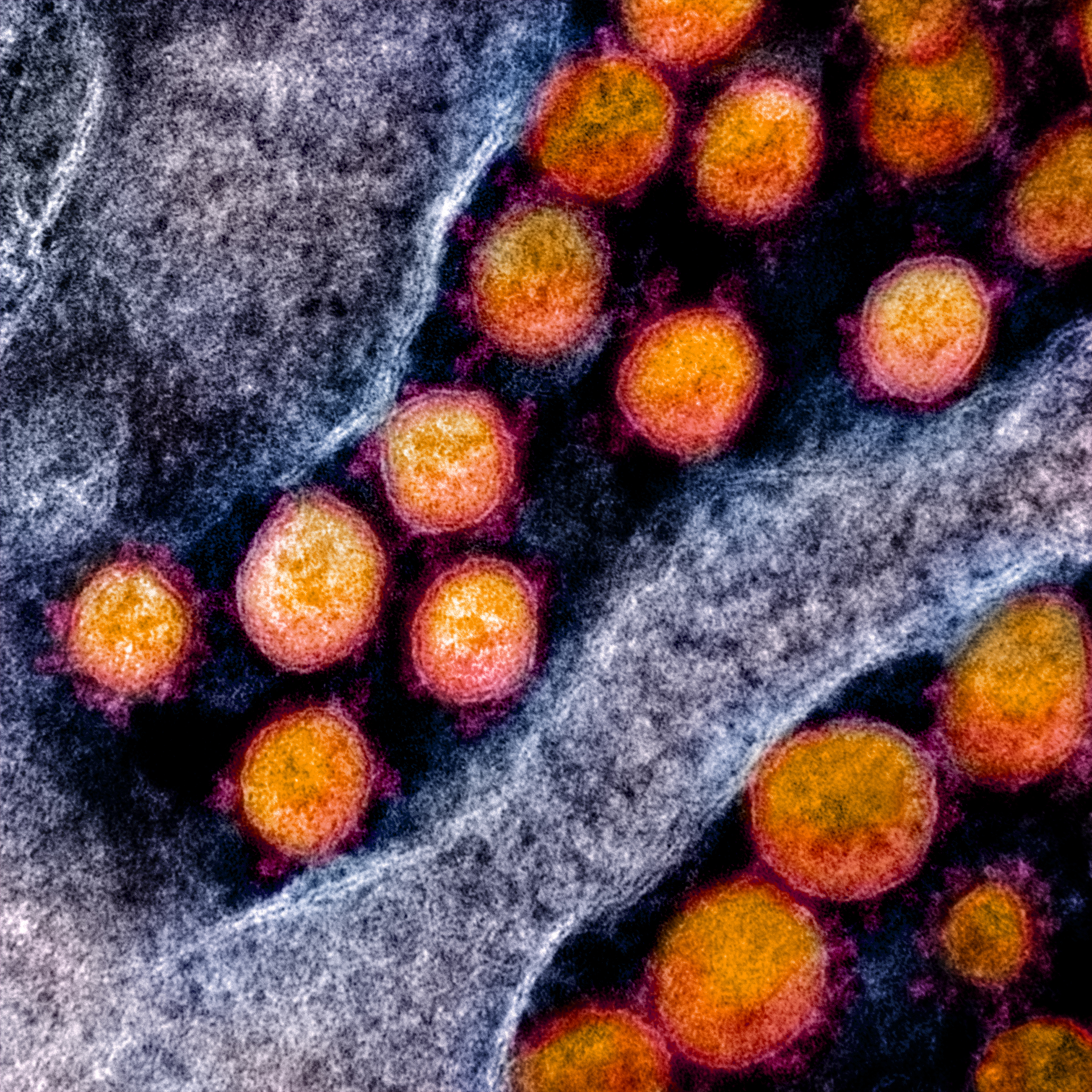Here's what a coronavirus actually looks like — and how to kill it
