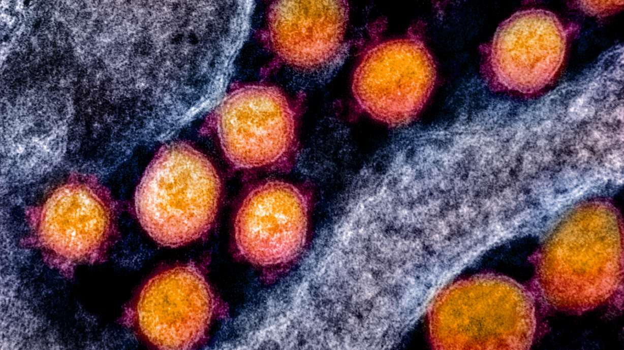 Here's what a coronavirus actually looks like — and how to kill it