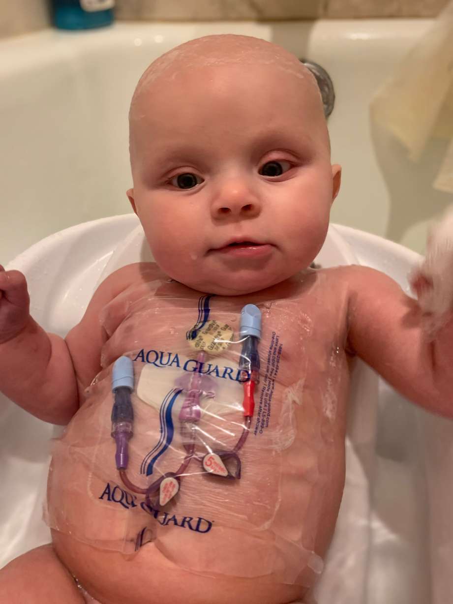 Casey and Kayla Hendricks regularly clean Lettie's central line where she is administered chemo. (Family Photo)