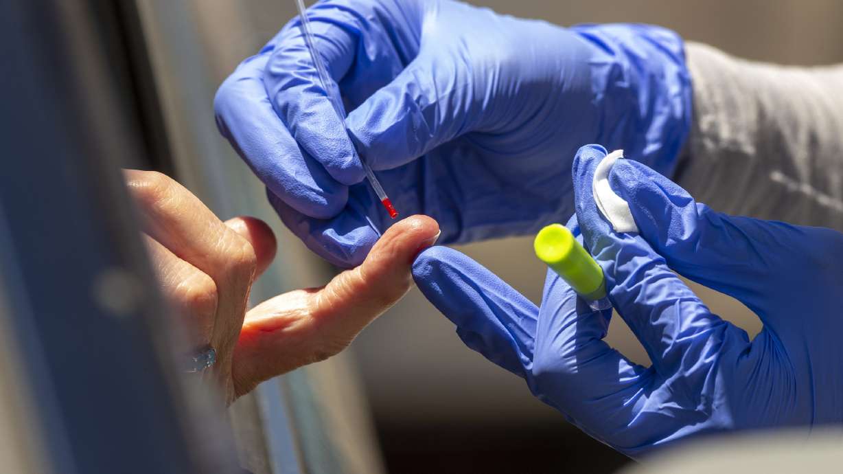 US begins crackdown on unvetted virus blood tests