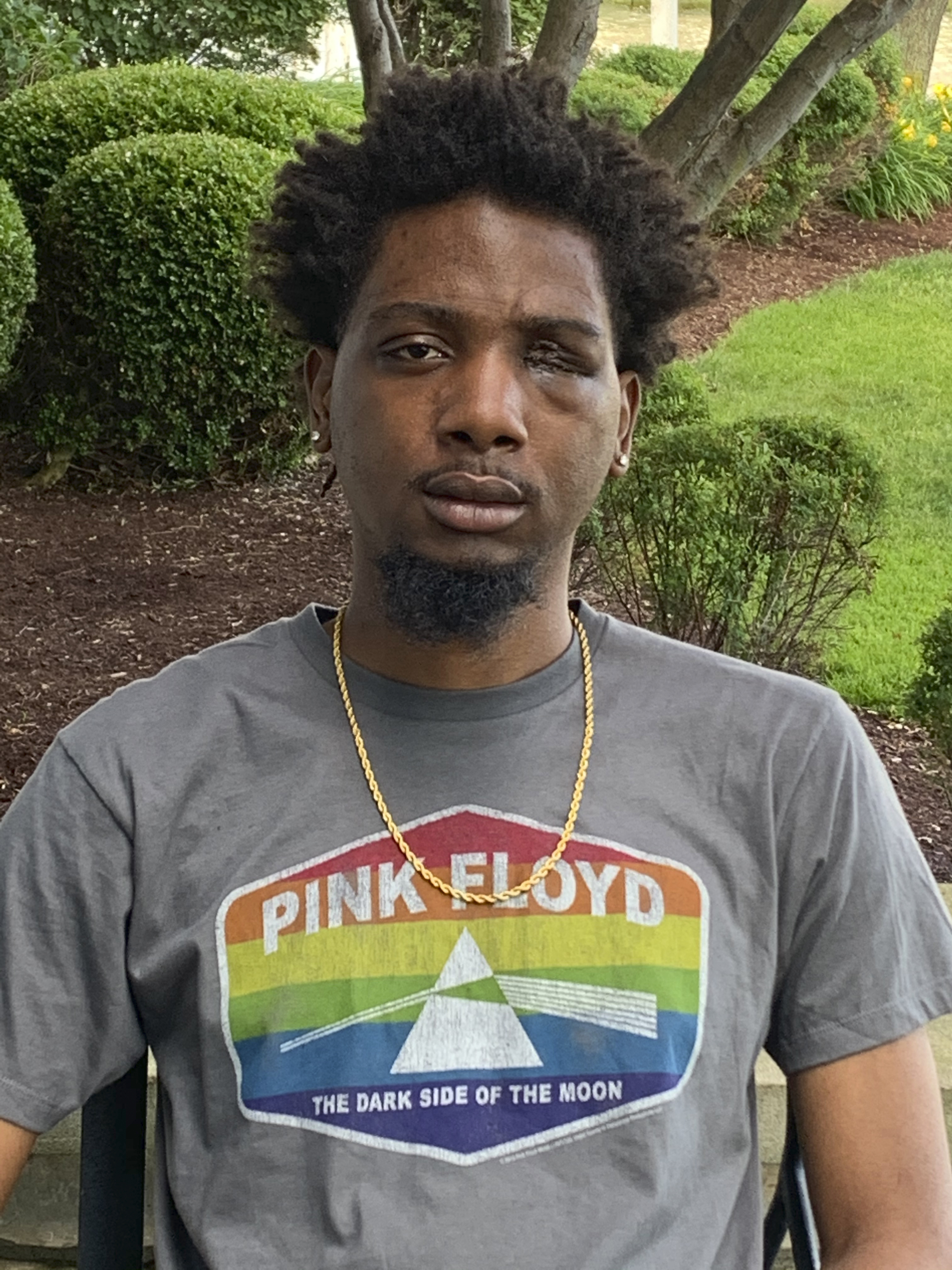 Probe underway of bean bag shot that blinded man in 1 eye