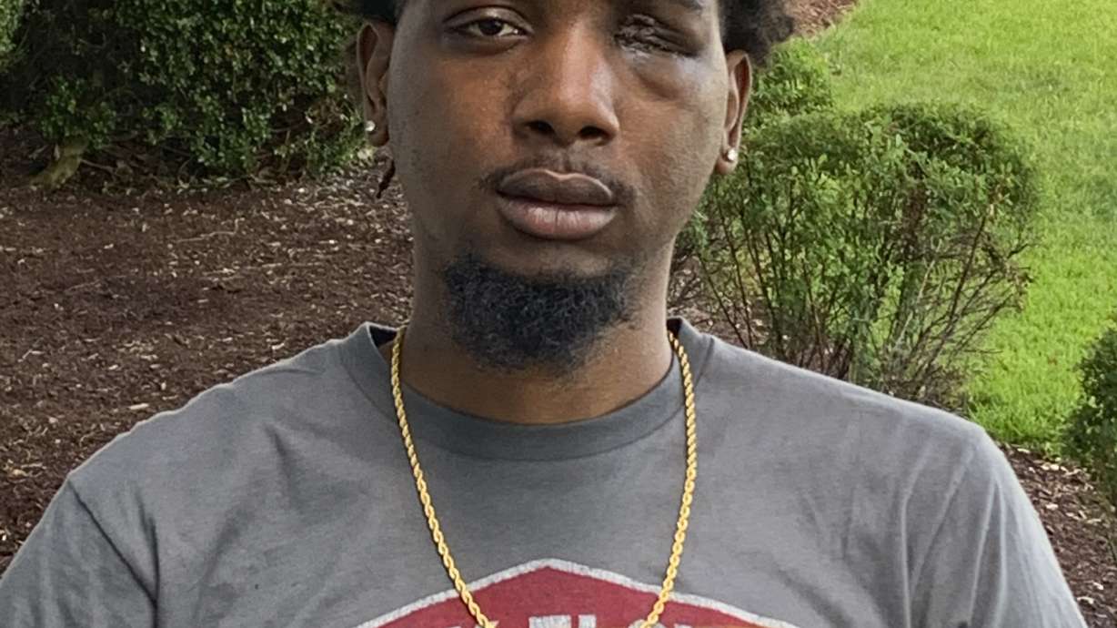 Probe underway of bean bag shot that blinded man in 1 eye