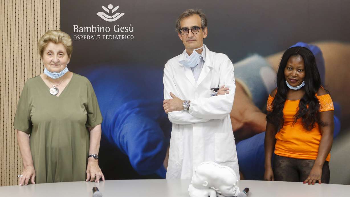 Twins joined at head separated at Vatican pediatric hospital