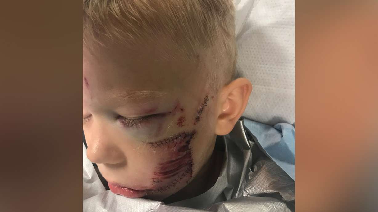Real-life superhero: In saving sister, 6-year-old Wyoming boy takes brunt of dog attack