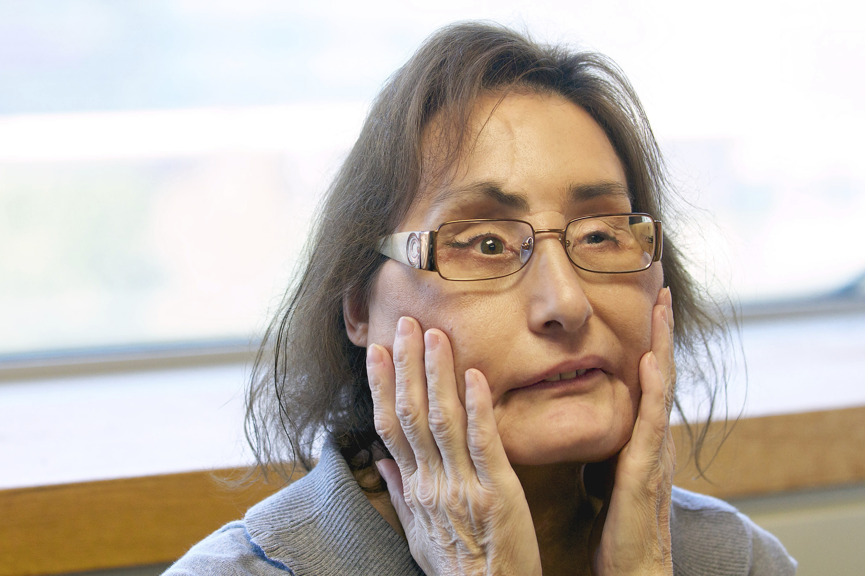 Connie Culp, 1st US partial face transplant recipient, dies