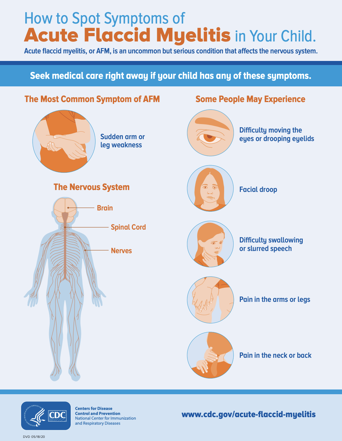How to Spot Symptoms of
Acute Flaccid Myelitis in Your Child.