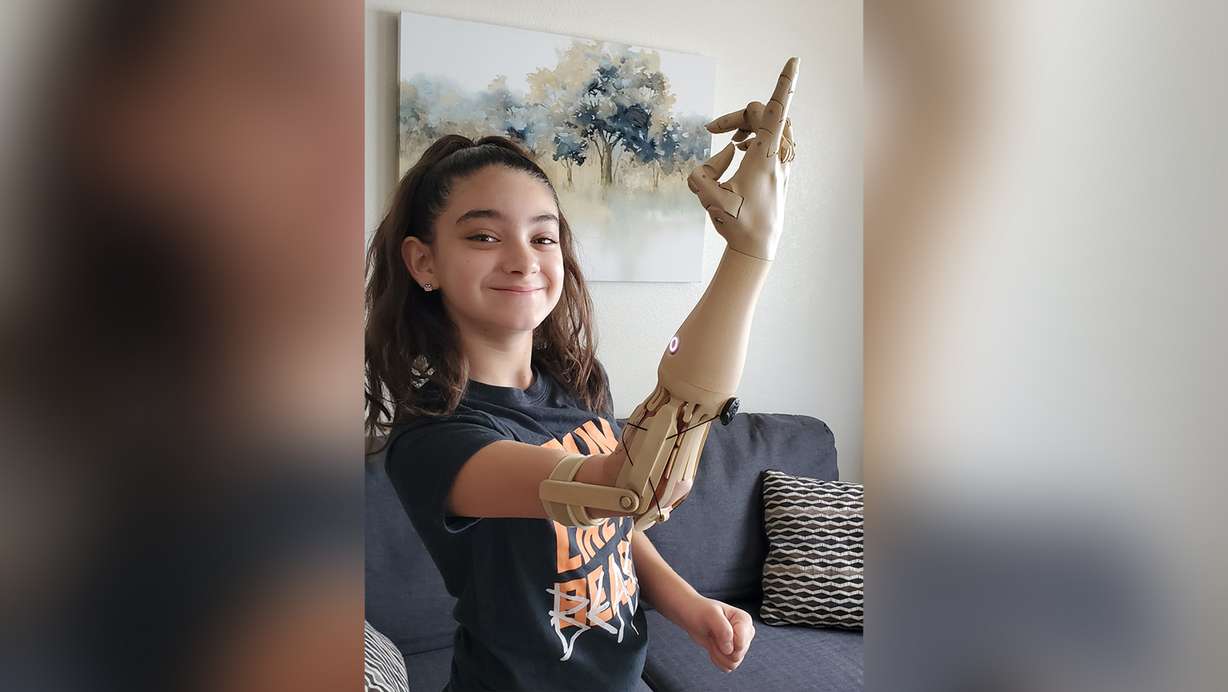 Natasha Castrejon, 9, uses TrueLimb to help her with her physical needs.