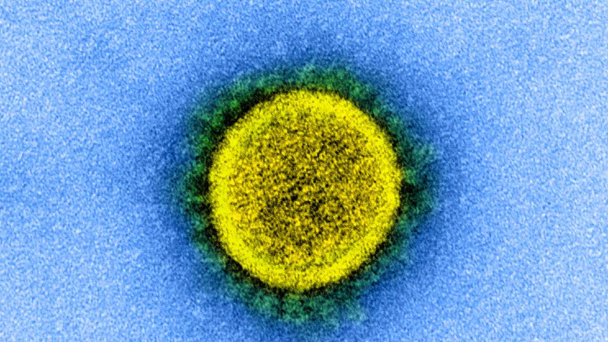 Transmission electron micrograph of a SARS-CoV-2 virus, isolated from a patient.