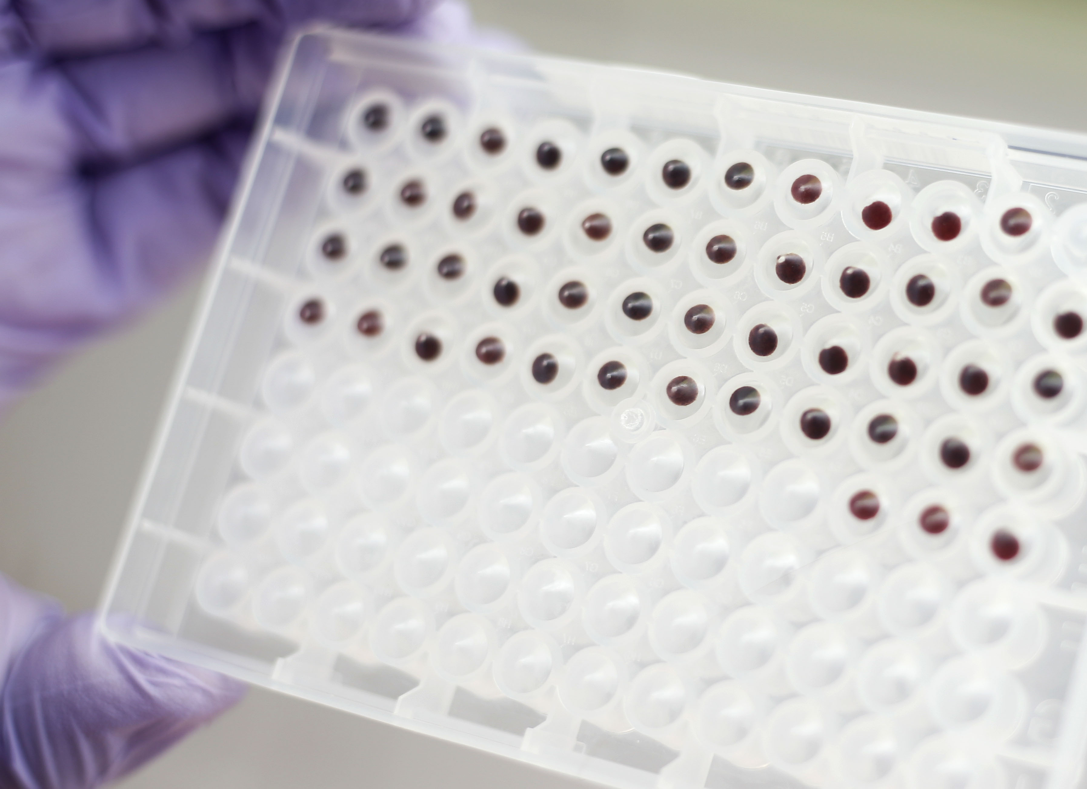 A plate containing blood samples from newborns is pictured in the Utah Department of Health's Newborn Screening Lab in Taylorsville on Thursday, Oct. 1, 2020. The department's Newborn Screening Program announced babies in Utah will now be screened for adrenoleukodystrophy, or ALD, a rare metabolic disorder that affects how the body breaks down food into energy.