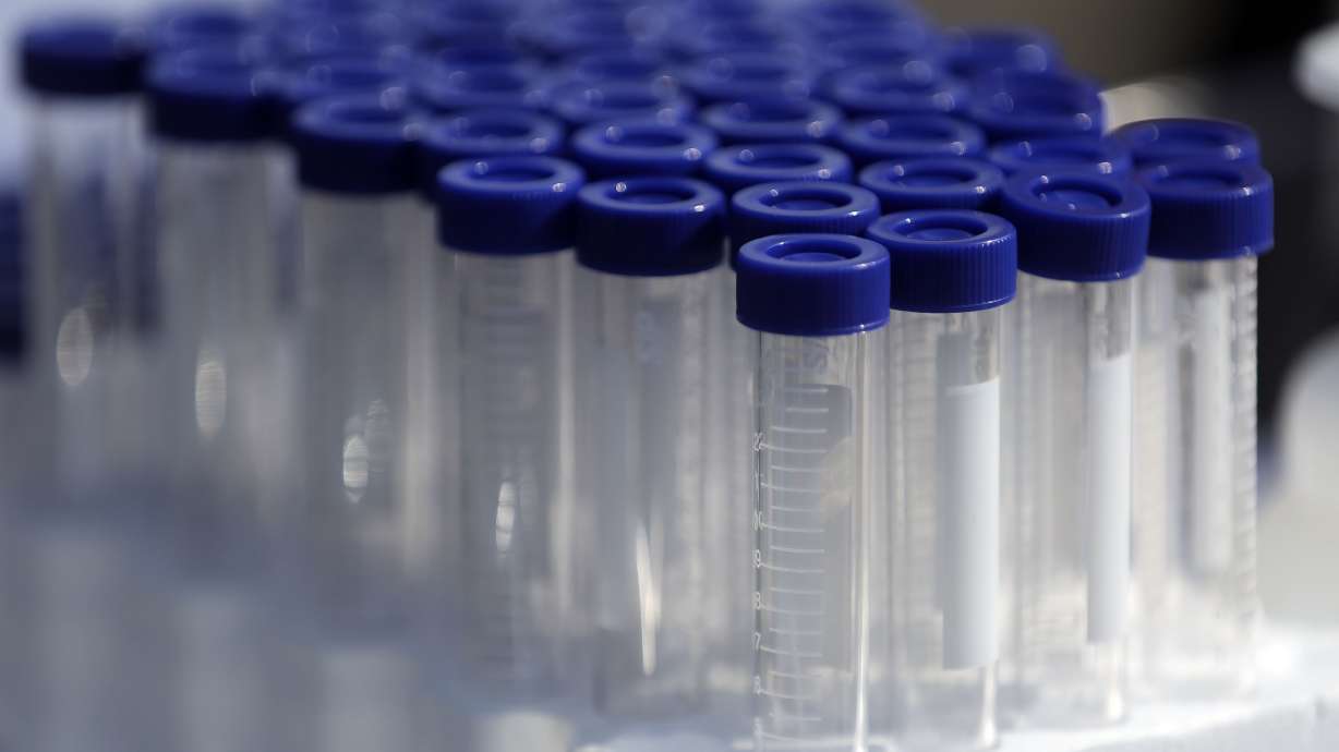 Vials are ready to collect saliva at an Intermountain Healthcare COVID-19 mobile testing site outside of Orem Community Hospital in Orem on Tuesday, Oct. 6, 2020.