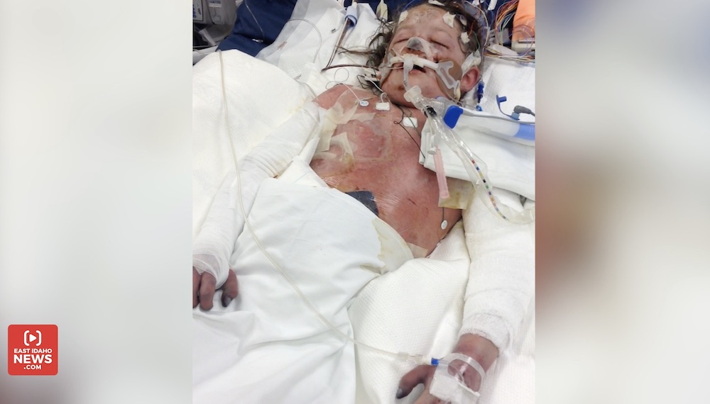 Doctors were forced to amputate Rosalie Parker’s arms, feet and legs after sepsis spread throughout her body.