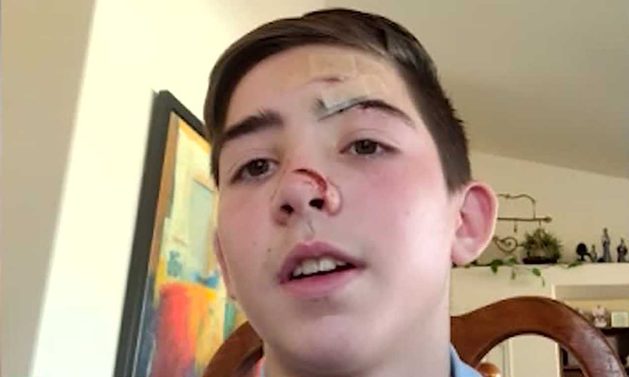 Bryan Carroll, 13, was hit by a car in a crosswalk in Farmington.